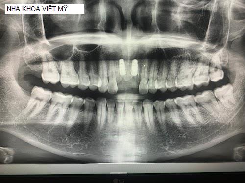 Hình ảnh NHA KHOA VIỆT MỸ